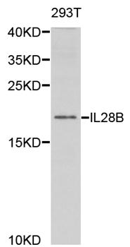 IL28B Antibody - Western blot analysis of extracts of 293T cells.