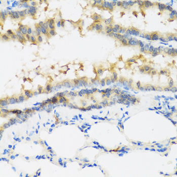 IL28B Antibody - Immunohistochemistry of paraffin-embedded mouse lung tissue.