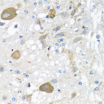 IL28B Antibody - Immunohistochemistry of paraffin-embedded rat brain tissue.
