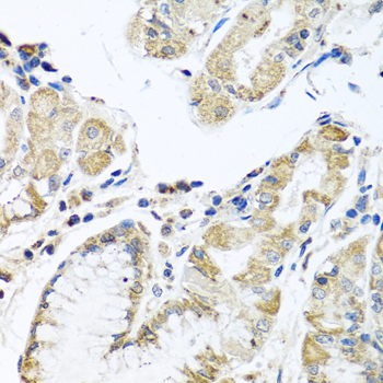 IL28B Antibody - Immunohistochemistry of paraffin-embedded human stomach tissue.
