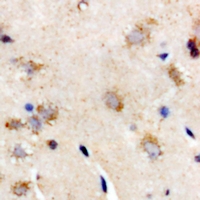 IL28B Antibody - Immunohistochemical analysis of Interferon lambda-3 staining in rat brain formalin fixed paraffin embedded tissue section. The section was pre-treated using heat mediated antigen retrieval with sodium citrate buffer (pH 6.0). The section was then incubated with the antibody at room temperature and detected using an HRP conjugated compact polymer system. DAB was used as the chromogen. The section was then counterstained with hematoxylin and mounted with DPX.