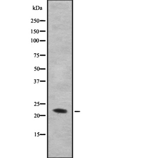 IL28B Antibody - Western blot analysis IL28B using HuvEc whole cells lysates