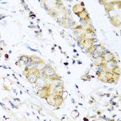 IL28B Antibody - Immunohistochemistry of paraffin-embedded Human stomach using IFNL3 Polyclonal Antibody at dilution of 1:100 (40x lens).