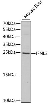 IL28B Antibody - Western blot analysis of extracts of mouse liver using IFNL3 Polyclonal Antibody at dilution of 1:1000.