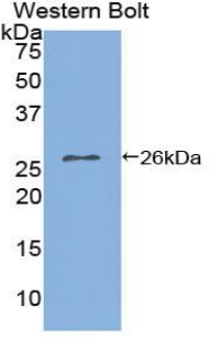 IL2RA / CD25 Antibody - Western blot of recombinant IL2RA / CD25.