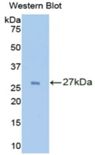 IL2RA / CD25 Antibody - Western blot of recombinant IL2RA / CD25.  This image was taken for the unconjugated form of this product. Other forms have not been tested.