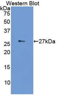 IL2RA / CD25 Antibody - Western blot of recombinant IL2RA / CD25. This image was taken for the unconjugated form of this product. Other forms have not been tested.
