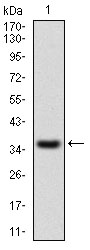 IL2RA / CD25 Antibody - Western blot using IL2RA monoclonal antibody against human IL2RA recombinant protein. (Expected MW is 37.5 kDa)