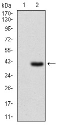 IL2RA / CD25 Antibody - Western blot using IL2RA monoclonal antibody against HEK293 (1) and IL2RA (AA: 34-139)-hIgGFc transfected HEK293 (2) cell lysate.