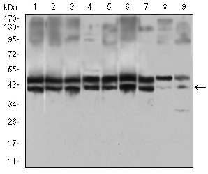 IL2RA / CD25 Antibody - Western blot using IL2RA mouse monoclonal antibody against HeLa (1), MOLT4 (2), HEK293 (3), A549 (4), Jurkat (5), K562 (6), Cos7 (7), PC-12 (8) and NIH/3T3 (9) cell lysate.