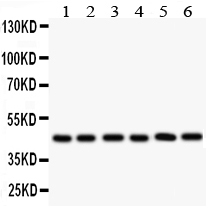 IL2RA / CD25 Antibody - anti-CD25/IL-2sR Alpha antibody, Western blotting All lanes: Anti CD25/IL-2sR Alpha at 0.5ug/ml Lane 1: SMMC Whole Cell Lysate at 40ugLane 2: A549 Whole Cell Lysate at 40ugLane 3: JURKAT Whole Cell Lysate at 40ugLane 4: MCF-7 Whole Cell Lysate at 40ugLane 5: RAJI Whole Cell Lysate at 40ugLane 6: PANC Whole Cell Lysate at 40ugPredicted bind size: 31KD Observed bind size: 45KD