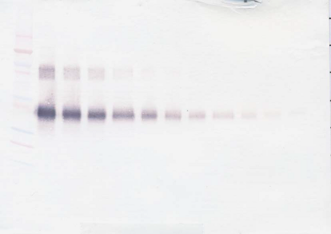 IL2RA / CD25 Antibody - Biotinylated Anti-Human sIL-2 Receptor a Western Blot Unreduced