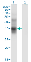 IL2RA / CD25 Antibody - Western Blot analysis of IL2RA expression in transfected 293T cell line by IL2RA monoclonal antibody (M04), clone 1D6.Lane 1: IL2RA transfected lysate (Predicted MW: 29.92 KDa).Lane 2: Non-transfected lysate.