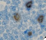 IL2RA / CD25 Antibody - IHC of CD25 on FFPE Tonsil tissue. This image was taken for the unmodified form of this product. Other forms have not been tested.