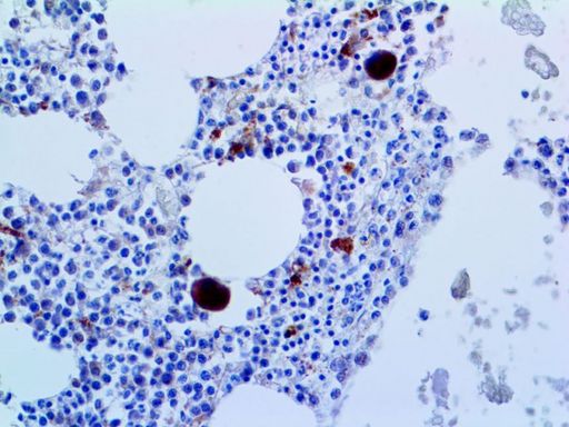 IL2RA / CD25 Antibody - IHC of CD25 on an FFPE Tonsil Tissue