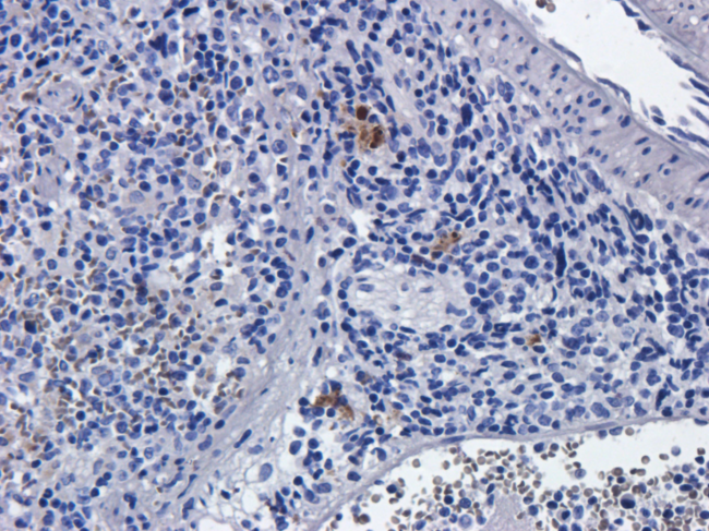IL2RA / CD25 Antibody - IHC on rat spleens.