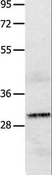 IL2RA / CD25 Antibody - Western blot analysis of A549 cell, using IL2RA Polyclonal Antibody at dilution of 1:750.