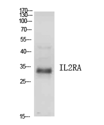 IL2RA / CD25 Antibody - Western blot analysis of extracts from 4T1 cells, using IL2RA Antibody.
