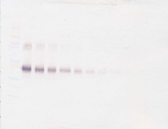 IL2RA / CD25 Antibody - Anti-Human sIL-2 Receptor a Western Blot Unreduced