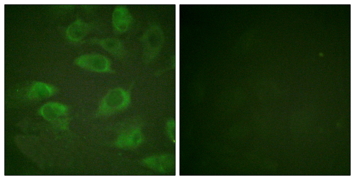 IL2RA / CD25 Antibody - Immunofluorescence analysis of HeLa cells, using IL-2R alpha/CD25 (Phospho-Ser268) Antibody. The picture on the right is blocked with the phospho peptide.
