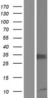 IL2RA / CD25 Protein - Western validation with an anti-DDK antibody * L: Control HEK293 lysate R: Over-expression lysate