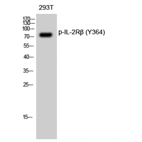 IL2RB / CD122 Antibody - Western blot of Phospho-IL-2Rbeta (Y364) antibody