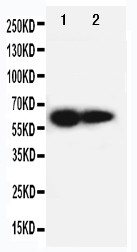 IL2RB / CD122 Antibody - WB of IL2RB / CD122 antibody. All lanes: Anti-IL2RB at 0.5ug/ml. Lane 1: PANC Whole Cell Lysate at 40ug. Lane 2: HELA Whole Cell Lysate at 40ug. Predicted bind size: 61KD. Observed bind size: 61KD.
