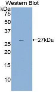 IL2RB / CD122 Antibody - Western blot of recombinant IL2RB / CD122.  This image was taken for the unconjugated form of this product. Other forms have not been tested.