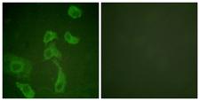 IL2RB / CD122 Antibody - Immunofluorescence analysis of HeLa cells, using IL-2R beta Antibody. The picture on the right is blocked with the synthesized peptide.