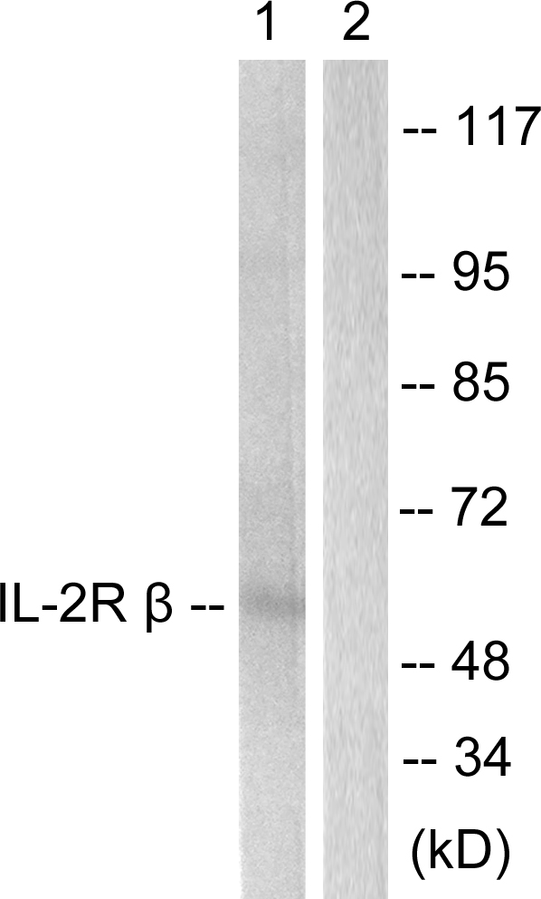 IL2RB / CD122 Antibody - Western blot analysis of lysates from HepG2 cells, using IL-2R beta Antibody. The lane on the right is blocked with the synthesized peptide.
