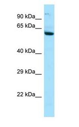 IL2RB / CD122 Antibody - IL2RB / CD122 antibody Western Blot of HepG2.  This image was taken for the unconjugated form of this product. Other forms have not been tested.