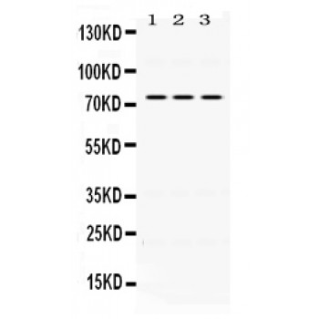 IL2RB / CD122 Antibody - IL2RB antibody Western blot. All lanes: Anti IL2RB at 0.5 ug/ml. Lane 1: Mouse Lung Tissue Lysate at 50 ug. Lane 2: Mouse Spleen Tissue Lysate at 50 ug. Lane 3: Mouse Testis Tissue Lysate at 50 ug. Predicted band size: 75 kD. Observed band size: 75 kD.