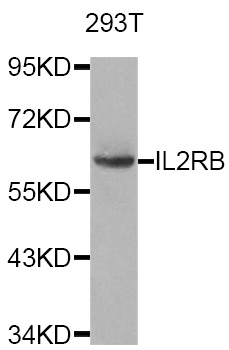 IL2RB / CD122 Antibody - Western blot analysis of extracts of 293T cells.