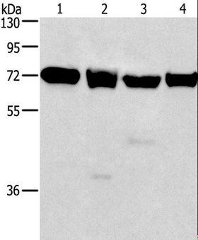 IL2RB / CD122 Antibody - Western blot analysis of 231, 293T, Raji and HeLa cell, using IL2RB Polyclonal Antibody at dilution of 1:325.