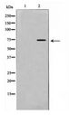 IL2RB / CD122 Antibody - Western blot of HeLa cell lysate using IL-2Rbeta/CD122 Antibody