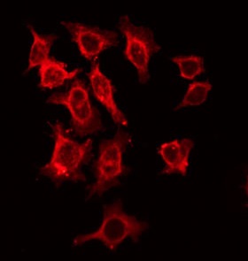 IL2RB / CD122 Antibody - Staining HeLa cells by IF/ICC. The samples were fixed with PFA and permeabilized in 0.1% Triton X-100, then blocked in 10% serum for 45 min at 25°C. The primary antibody was diluted at 1:200 and incubated with the sample for 1 hour at 37°C. An Alexa Fluor 594 conjugated goat anti-rabbit IgG (H+L) Ab, diluted at 1/600, was used as the secondary antibody.