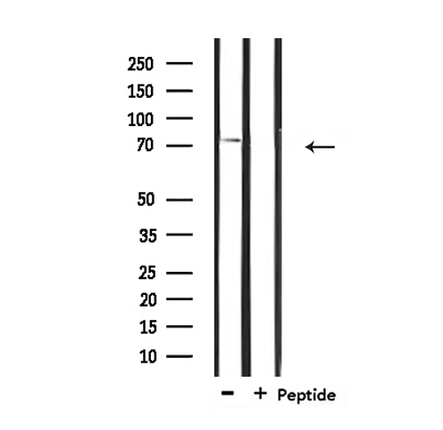 IL2RB / CD122 Antibody - Western blot analysis of extracts of 293 cells using IL-2Rbeta/CD122 antibody. The lane on the right is treated with the antigen-specific peptide.