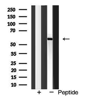 IL2RB / CD122 Antibody - Western blot analysis of Interleukin 2 receptor Beta expression in COLO cells