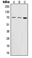 IL2RB / CD122 Antibody - Western blot analysis of CD122 expression in BJAB (A); HuT78 (B); CTLL2 (C) whole cell lysates.