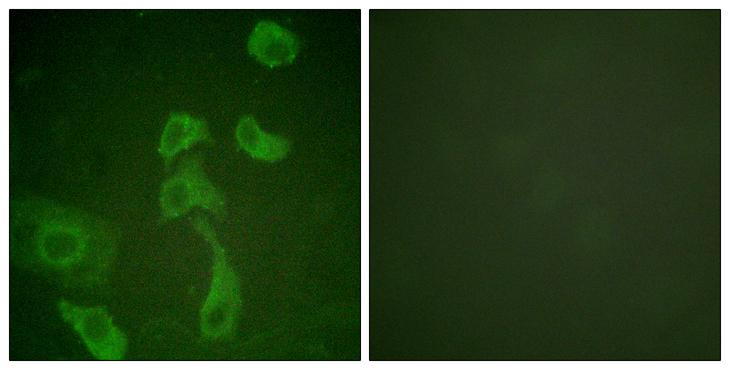 IL2RB / CD122 Antibody - Peptide - + Immunofluorescence analysis of HeLa cells, using IL-2Rß (Ab-364) antibody.
