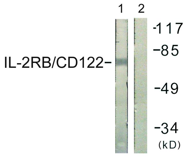 IL2RB / CD122 Antibody - Western blot analysis of extracts from COS7 cells, using IL-2Rß/CD122 (Ab-364) antibody.