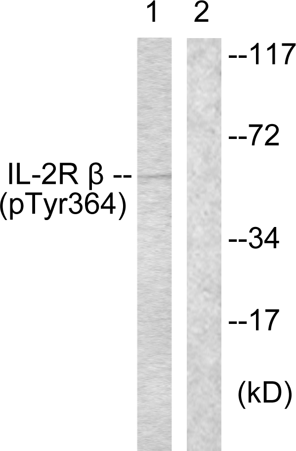 IL2RB / CD122 Antibody - Western blot analysis of lysates from HeLa cells, using IL-2R beta (Phospho-Tyr364) Antibody. The lane on the right is blocked with the phospho peptide.