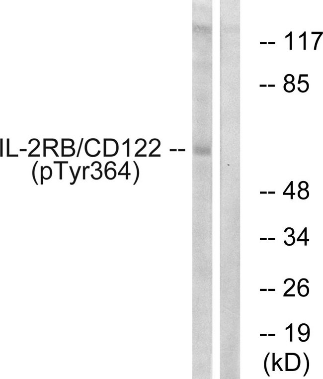 IL2RB / CD122 Antibody - Western blot analysis of lysates from COS7 cells, using IL-2R beta/CD122 (Phospho-Tyr364) Antibody. The lane on the right is blocked with the phospho peptide.