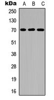 IL2RB / CD122 Antibody - Western blot analysis of CD122 (pY364) expression in Raji (A); NIH3T3 (B); rat muscle (C) whole cell lysates.