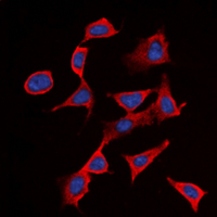 IL2RB / CD122 Antibody - Immunofluorescent analysis of CD122 (pY364) staining in Raji cells. Formalin-fixed cells were permeabilized with 0.1% Triton X-100 in TBS for 5-10 minutes and blocked with 3% BSA-PBS for 30 minutes at room temperature. Cells were probed with the primary antibody in 3% BSA-PBS and incubated overnight at 4 ??C in a humidified chamber. Cells were washed with PBST and incubated with a DyLight 594-conjugated secondary antibody (red) in PBS at room temperature in the dark. DAPI was used to stain the cell nuclei (blue).