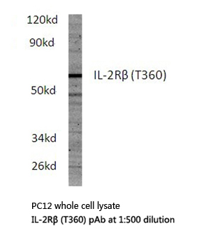 IL2RB / CD122 Antibody - Western blot of IL-2R (T360) pAb in extracts from PC12 cells.