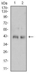 IL2RG / CD132 Antibody - Western blot analysis using CD132 mouse mAb against Jurkat (1) and MOLT4 (2) cell lysate.