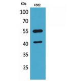 IL2RG / CD132 Antibody - Western blot of IL-2Rgamma antibody