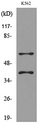 IL2RG / CD132 Antibody - Western blot analysis of lysate from K562 cells, using IL2RG Antibody.