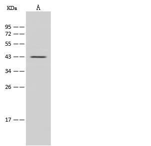 IL2RG / CD132 Antibody - Anti-IL2RG rabbit polyclonal antibody at 1:500 dilution. Lane A: Jurkat Whole Cell Lysate. Lysates/proteins at 30 ug per lane. Secondary: Goat Anti-Rabbit IgG (H+L)/HRP at 1/10000 dilution. Developed using the ECL technique. Performed under reducing conditions. Predicted band size: 42 kDa. Observed band size: 42 kDa.